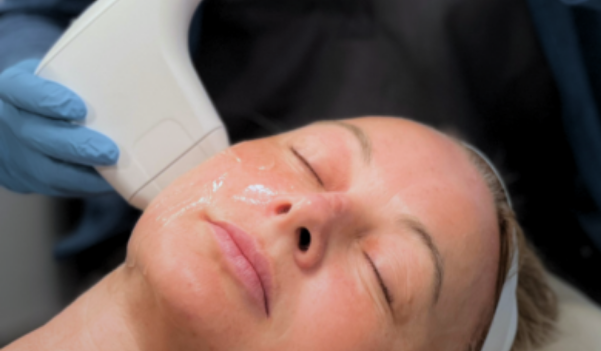 Woman receiving Sofwave treatment on the face